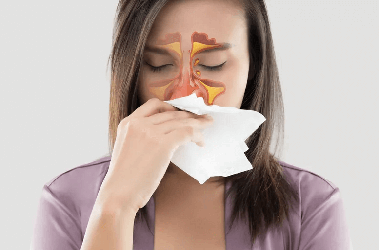 Woman with sinus infection sinusitis and the use of colloidal nano silver